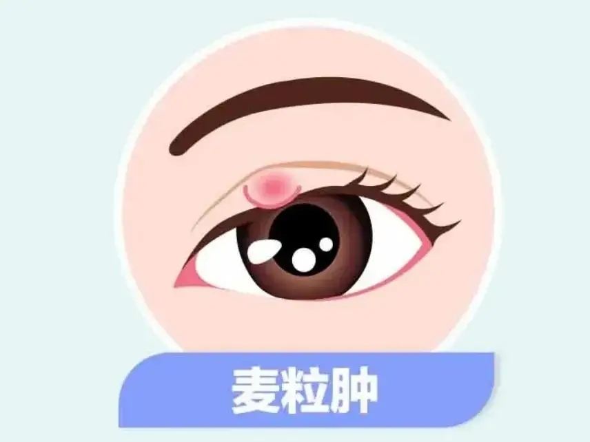 eb81faad4ace84ec362f78986fcddfb3_e545d38d39f742c29f27bf06433869ab.jpeg